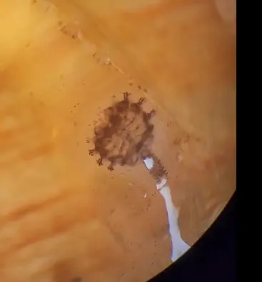 Shrimp Gill Isopod